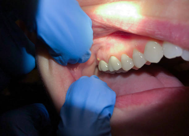 Best Emergency TMJ Treatment in Lutcher, LA